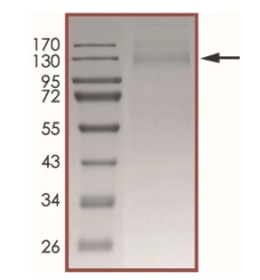 The purity of nCoV-S1 (Δ69-70, N501Y, D614G) was determined to be >90% by densitometry
